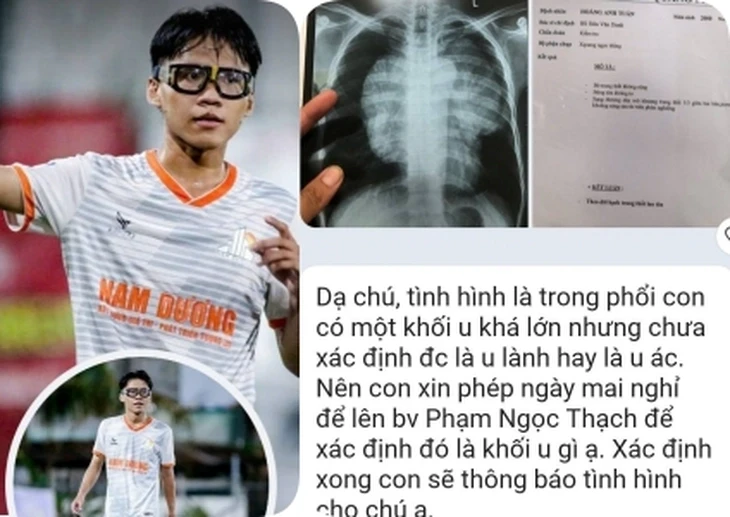 Cựu tuyển thủ Vũ Duy Hoàng tiếp sức thanh niên bị ung thư Cựu tuyển thủ Vũ Duy Hoàng tiếp sức thanh niên bị ung thư