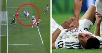 Mbappe bị thúc cùi chỏ&nbsp;chảy máu, Real Madrid kêu oan đòi phạt đền