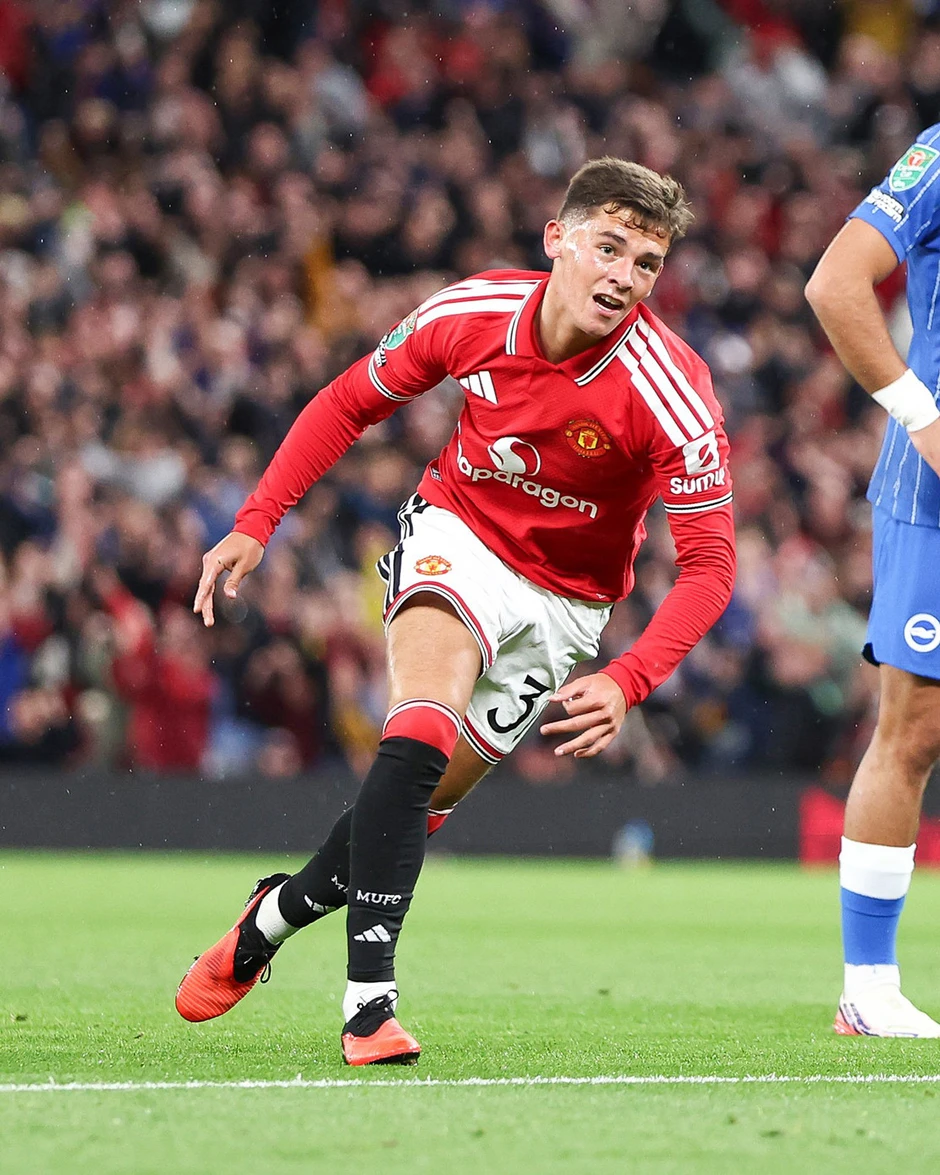 MU thua ngược khó tin trước Brighton ở cúp Liên đoàn Anh MU thua ngược khó tin trước Brighton ở cúp Liên đoàn Anh