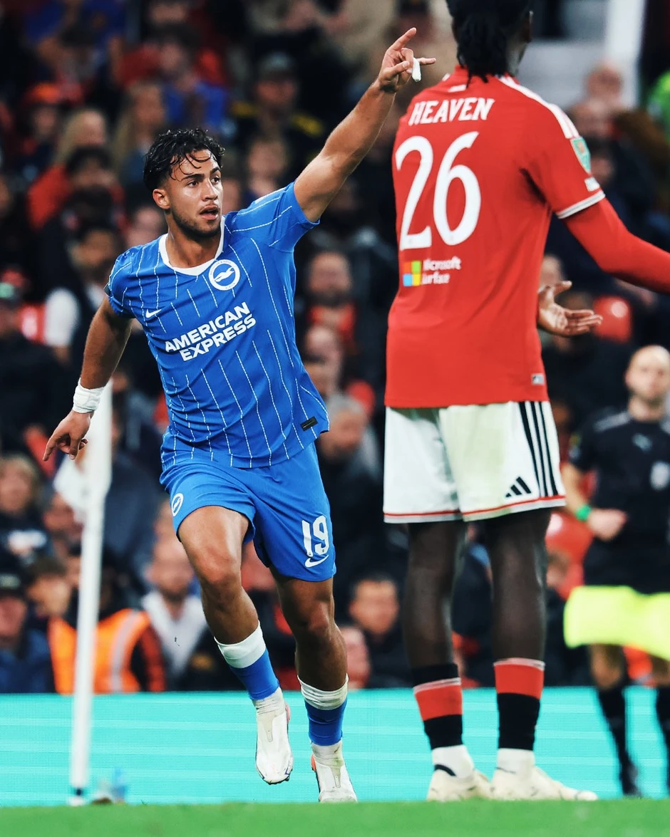 MU thua ngược khó tin trước Brighton ở cúp Liên đoàn Anh MU thua ngược khó tin trước Brighton ở cúp Liên đoàn Anh