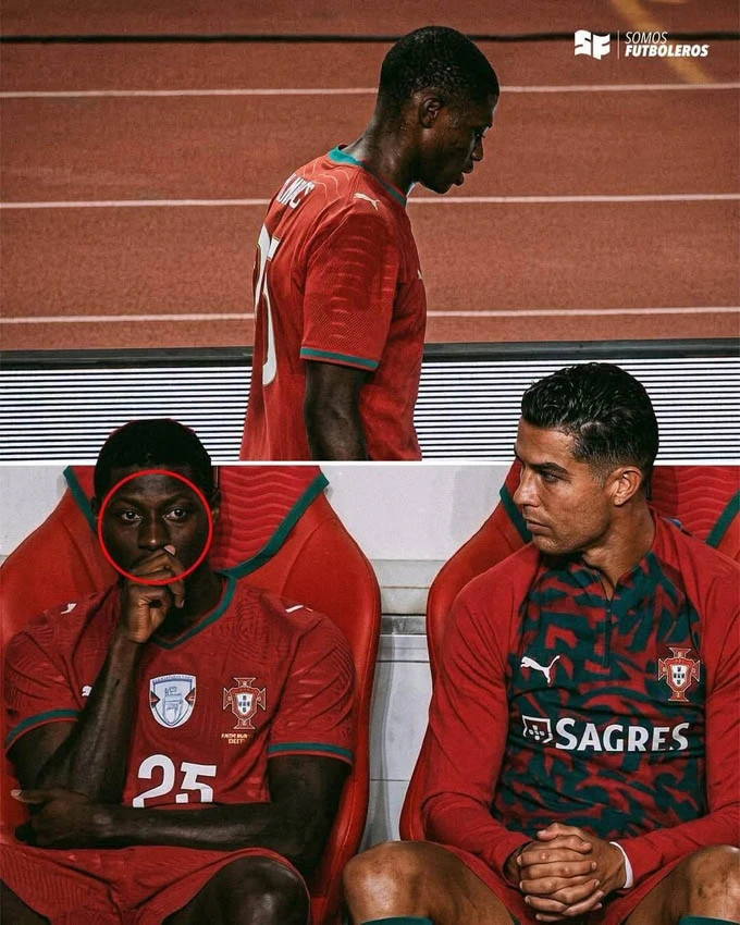 Bồ Đào Nha nguy cơ mất hậu vệ trái số 1 thế giới ở ngày ra quân World Cup