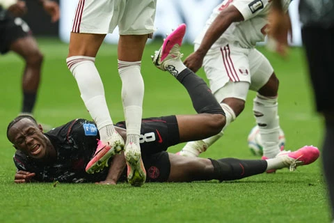 Cầu thủ Canada chấn thương kinh hoàng ở trận đại thắng Qatar 6-0 Cầu thủ Canada chấn thương kinh hoàng ở trận đại thắng Qatar 6-0