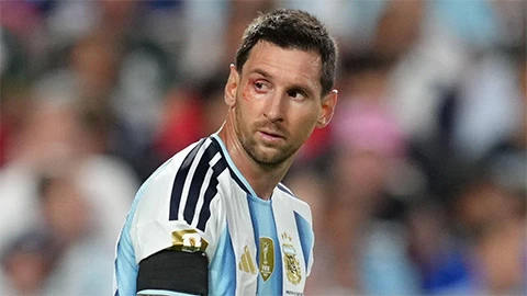 Messi lỡ buổi tập của Argentina trước trận gặp Anh Messi lỡ buổi tập của Argentina trước trận gặp Anh