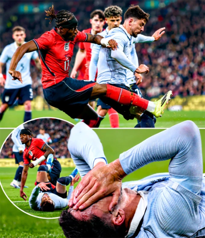 Sao Arsenal khiến hậu vệ Uruguay dính chấn thương 'khó đỡ'