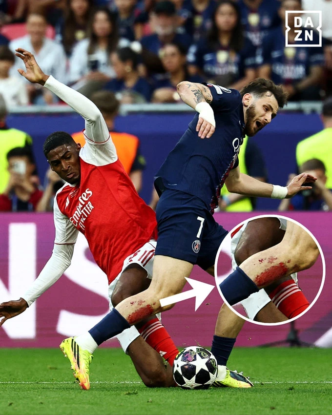 Khvicha Kvaratskhelia đưa PSG đến đỉnh châu Âu với đôi chân tứa máu