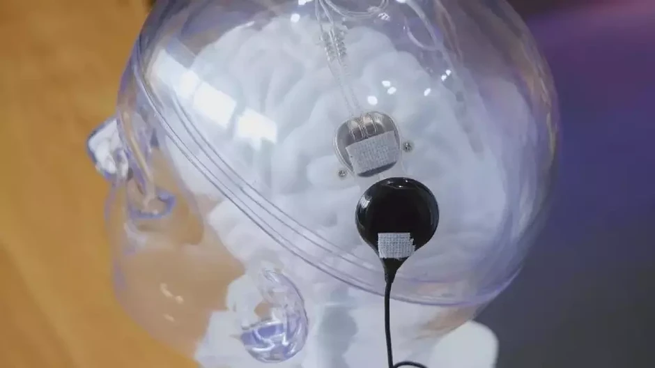 Trung Quốc hoàn thành ca cấy chip não - máy tính thương mại đầu tiên Trung Quốc hoàn thành ca cấy chip não - máy tính thương mại đầu tiên