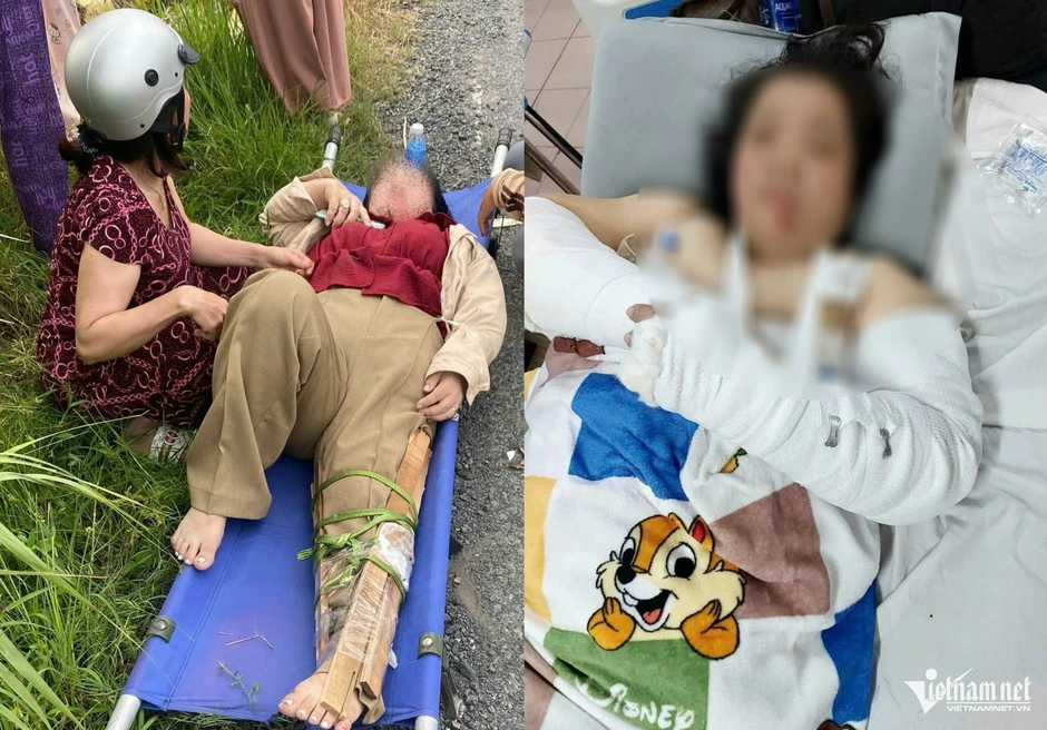 Liên tiếp 3 vụ tai nạn trên đoạn đường chi chít ổ gà, có cô giáo gãy cả tay và chân Liên tiếp 3 vụ tai nạn trên đoạn đường chi chít ổ gà, có cô giáo gãy cả tay và chân