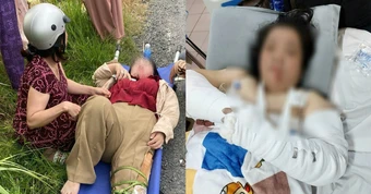 Liên tiếp 3 vụ tai nạn trên đoạn đường chi chít ổ gà, có cô giáo gãy cả tay và chân