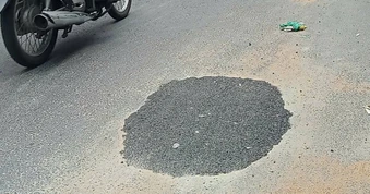 Đã trám hố sâu