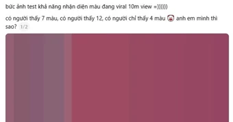 “Bức ảnh đếm màu đang viral với 10 triệu view”: Đáp án cuối cùng là gì?