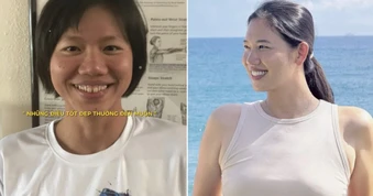 Ánh Viên trước và sau khi niềng răng