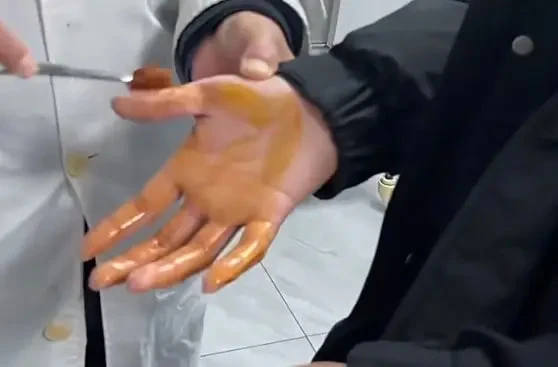 Bé trai bị "kim vô hình" từ 1 chiếc chăn đâm khắp người, cha mẹ hoảng loạn, gỡ mãi không hết Bé trai bị "kim vô hình" từ 1 chiếc chăn đâm khắp người, cha mẹ hoảng loạn, gỡ mãi không hết