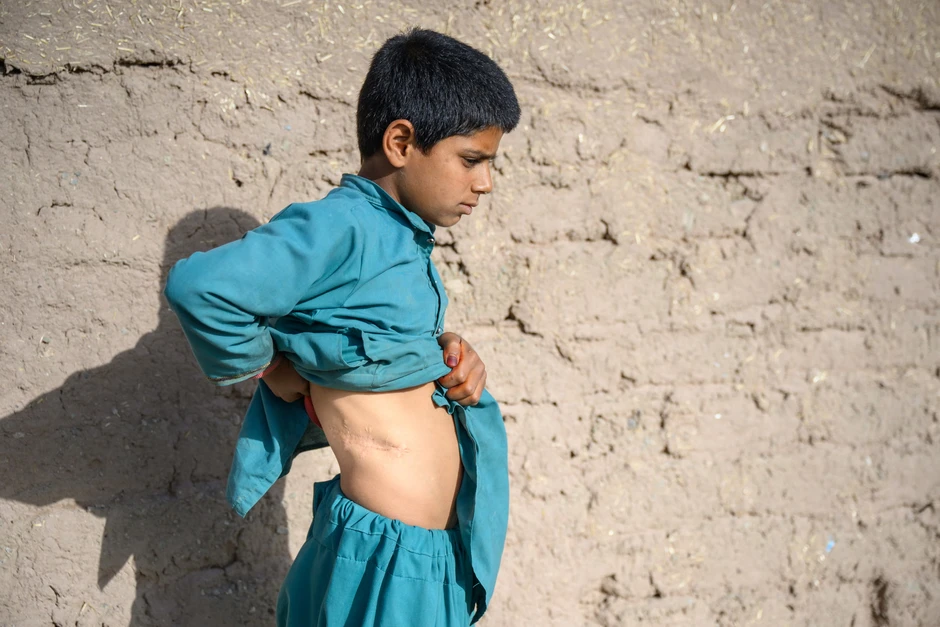 Biến đổi khí hậu buộc các gia đình Afghanistan phải bán con gái làm cô dâu Biến đổi khí hậu buộc các gia đình Afghanistan phải bán con gái làm cô dâu