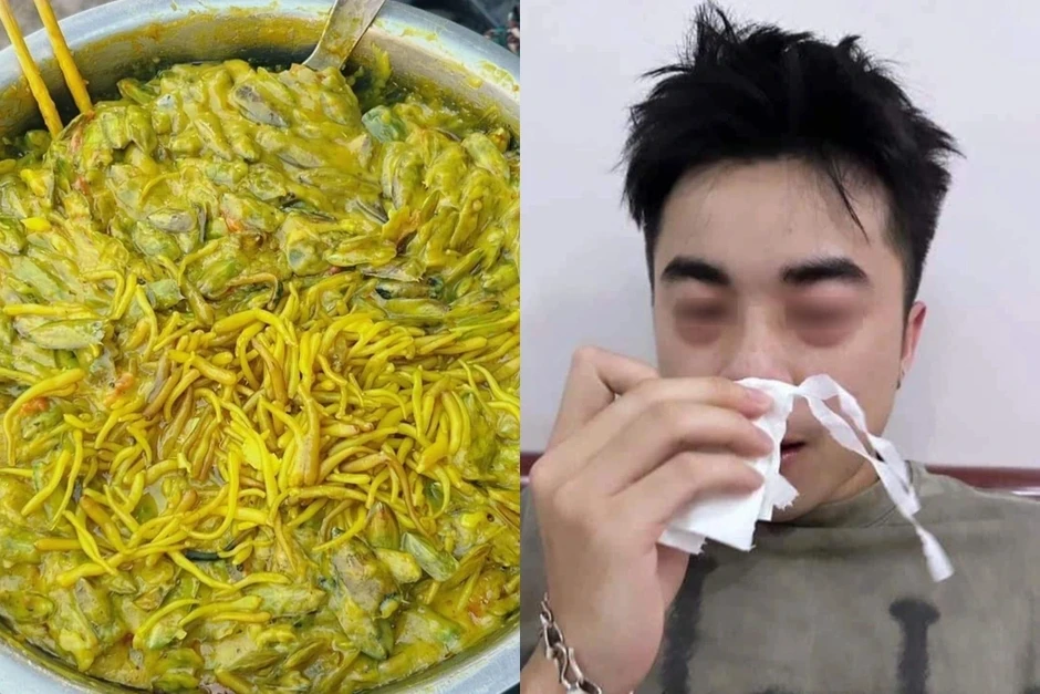 Chàng trai Hà Nội sưng mắt, khó thở vì món đặc sản "khổ trước, sướng sau" Chàng trai Hà Nội sưng mắt, khó thở vì món đặc sản "khổ trước, sướng sau"