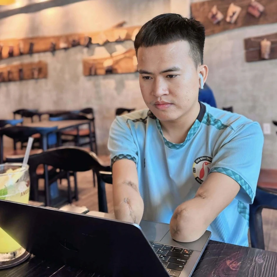 Chuyện tình với bạn gái xinh đẹp làm thay đổi chàng trai cụt hai tay Chuyện tình với bạn gái xinh đẹp làm thay đổi chàng trai cụt hai tay