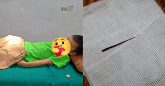 Con trai chịu đau cả buổi chiều không dám báo cô, bố mẹ sốc với kết quả