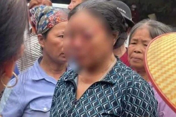 Con trai người bán rau bị xịt nước vào mặt: "Mẹ tôi vẫn đau, hoảng loạn"