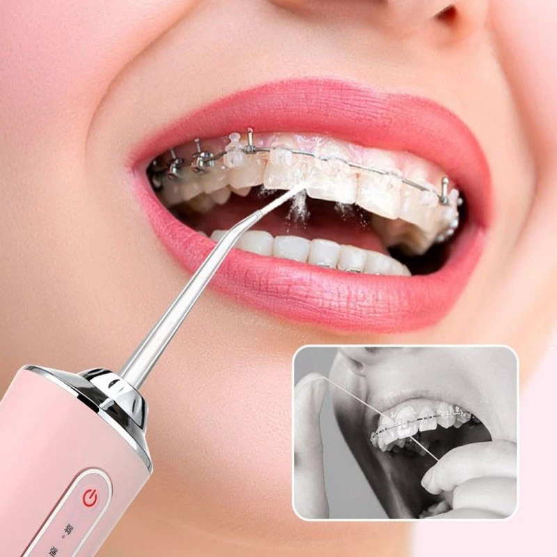 Lời khuyên cho người cứ ăn xong là tìm tăm xỉa răng Lời khuyên cho người cứ ăn xong là tìm tăm xỉa răng