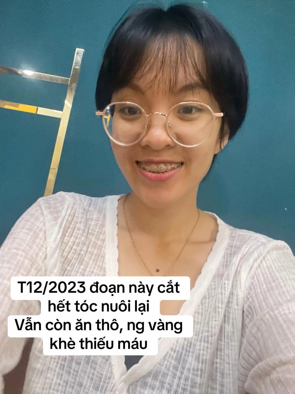 Màn thay đổi "đáng đồng tiền" của cô gái TP.HCM sau khi từ bỏ ăn thô, niềng răng và mổ mắt cận Màn thay đổi "đáng đồng tiền" của cô gái TP.HCM sau khi từ bỏ ăn thô, niềng răng và mổ mắt cận