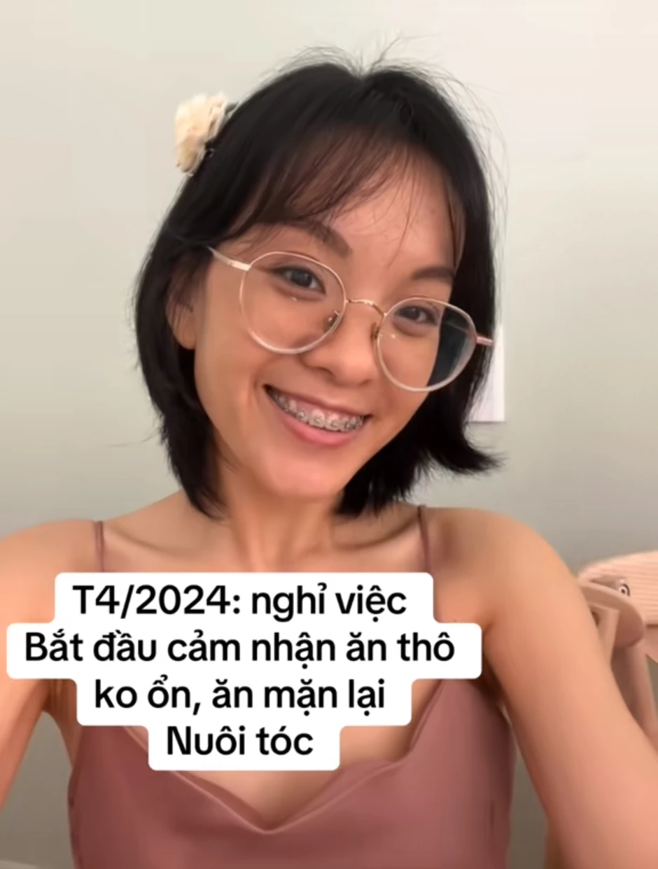 Màn thay đổi "đáng đồng tiền" của cô gái TP.HCM sau khi từ bỏ ăn thô, niềng răng và mổ mắt cận Màn thay đổi "đáng đồng tiền" của cô gái TP.HCM sau khi từ bỏ ăn thô, niềng răng và mổ mắt cận