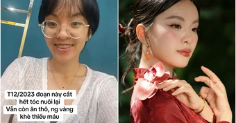 Màn thay đổi "đáng đồng tiền" của cô gái TP.HCM sau khi từ bỏ ăn thô, niềng răng và mổ mắt cận