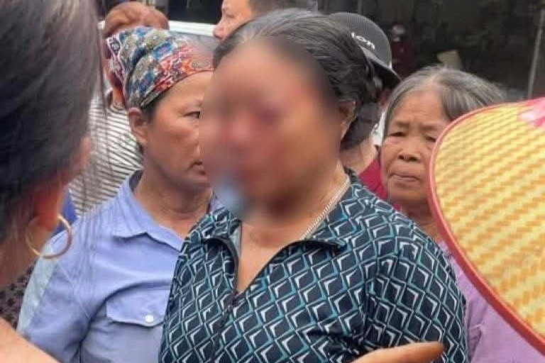 Nhân chứng kể phút người phụ nữ bán rau bị xịt nước áp lực cao vào mặt Nhân chứng kể phút người phụ nữ bán rau bị xịt nước áp lực cao vào mặt
