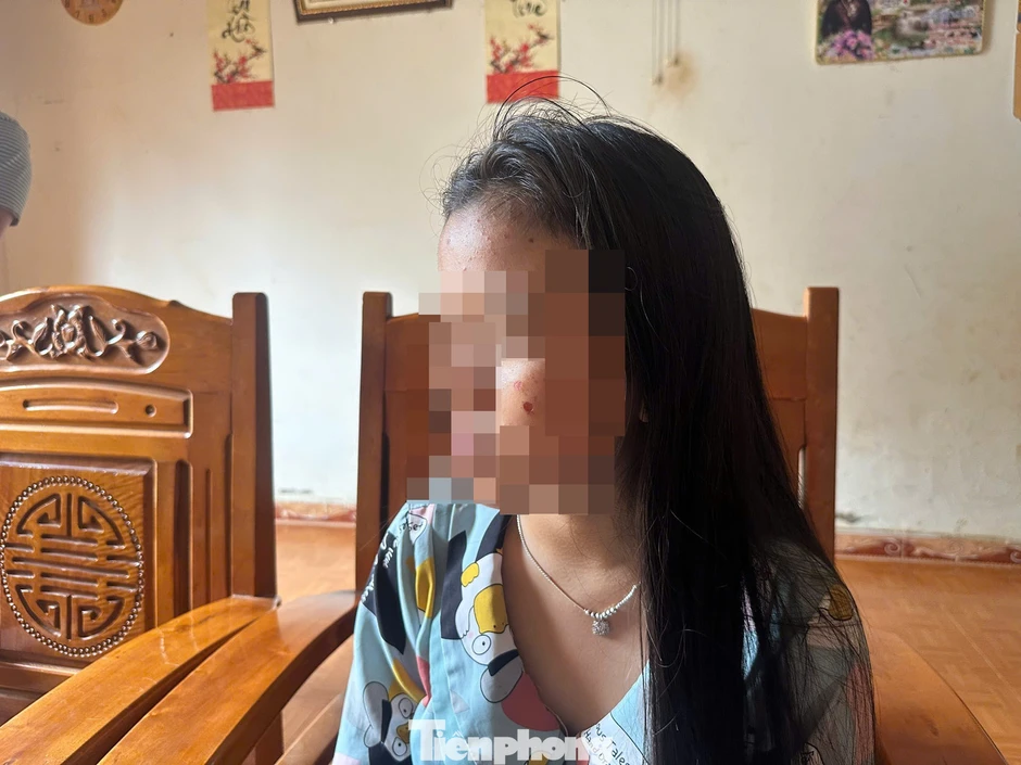 Nhát dao, điếu thuốc cháy trên mặt nữ sinh và câu hỏi dành cho người lớn Nhát dao, điếu thuốc cháy trên mặt nữ sinh và câu hỏi dành cho người lớn