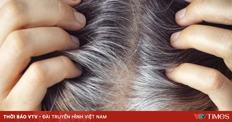 Những loại quả ăn thường xuyên giúp ngăn tóc bạc sớm
