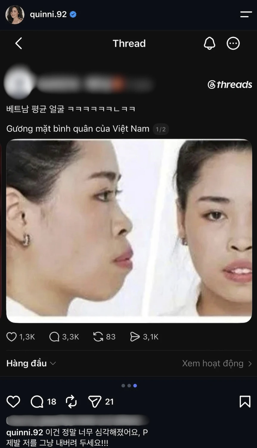 Nữ chính từng "thay đầu" thành công nhất Việt Nam dính vào drama miệt thị nhan sắc