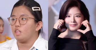 Nữ sinh từng bị gọi là “quái vật” và 3 cuộc đại phẫu tìm lại nụ cười