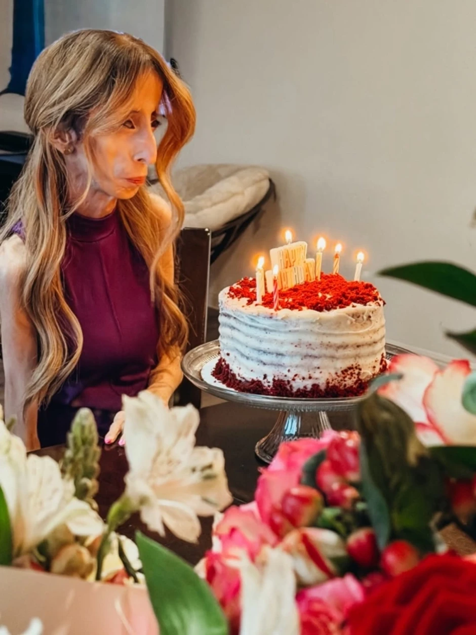 Sự lột xác của 'người phụ nữ xấu nhất thế giới' Sự lột xác của 'người phụ nữ xấu nhất thế giới'