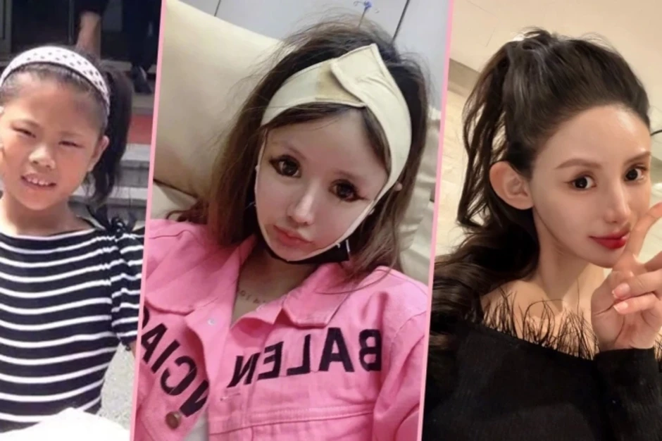 Sự thật phía sau 'cơn sốt dao kéo' của Gen Z Sự thật phía sau 'cơn sốt dao kéo' của Gen Z