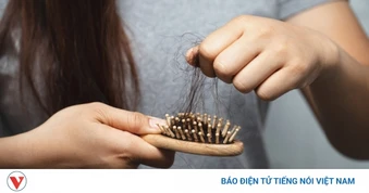 Tóc rụng cả nắm khi gội đầu, đừng bỏ qua 5 cách này