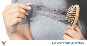 Tóc rụng nhiều mùa hè: 7 mẹo đơn giản giúp tóc chắc khỏe hơn