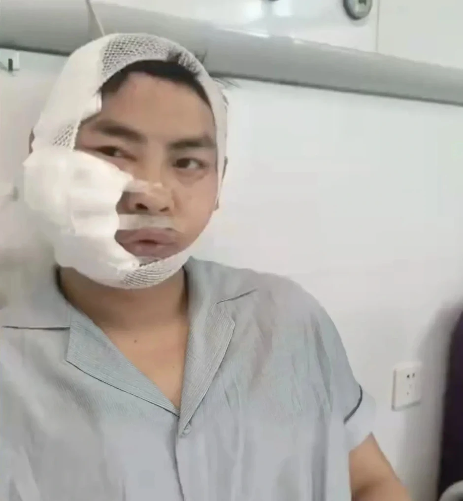 Khách Trung Quốc bất ngờ bị cá mập 3m tấn công khi lặn trong thủy cung