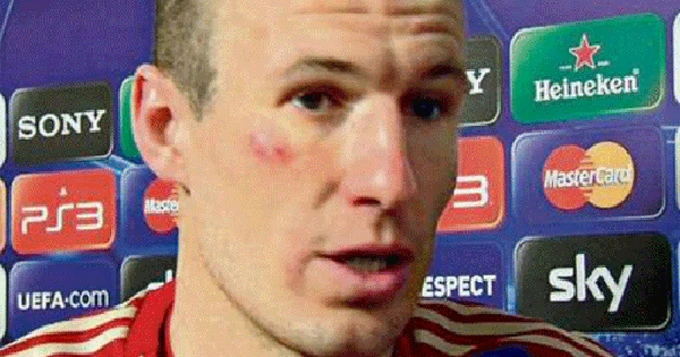 Ribery & cú đấm vào mặt Robben làm Bayern rung chuyển Ribery & cú đấm vào mặt Robben làm Bayern rung chuyển