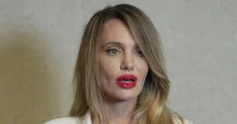 Angelina Jolie lộ diện mạo gầy gò, chia sẻ hành trình giành sự sống
