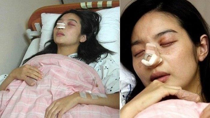 Bi kịch nữ diễn viên ly hôn sau 12 ngày cưới vì bị chồng đánh sảy thai, nhìn thương tích mà nhói lòng Bi kịch nữ diễn viên ly hôn sau 12 ngày cưới vì bị chồng đánh sảy thai, nhìn thương tích mà nhói lòng
