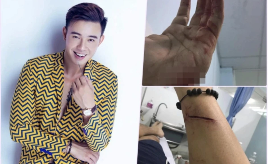 Ca sĩ Việt hát ca khúc 10 tỷ view vang danh Đại lễ: Gánh nợ 28 tỷ ở tuổi 20, đoạn tâm thư thấy rõ sự thật