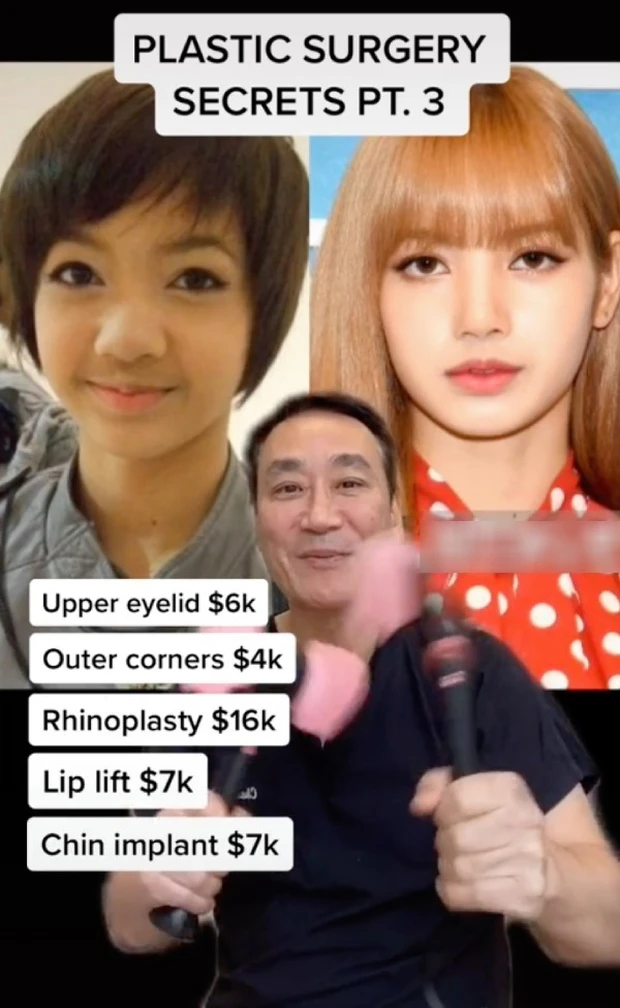 Lisa (BLACKPINK) “dao kéo” quá tay đến mức phá nét, fan cũng ngớ cả người Lisa (BLACKPINK) “dao kéo” quá tay đến mức phá nét, fan cũng ngớ cả người