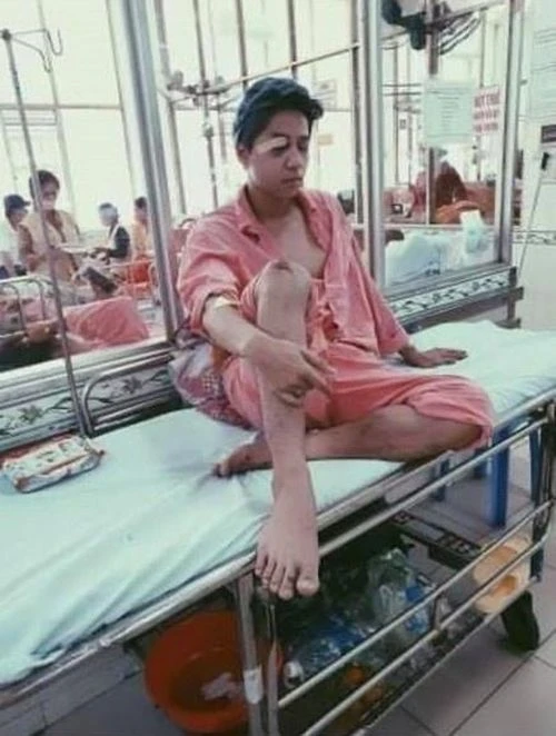 Nam ca sĩ điển trai từng vỡ xương gò má, liệt nửa mặt: Lui về hậu trường suốt nhiều năm