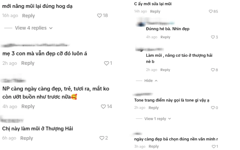 Nhã Phương mới thẩm mỹ lại 1 điểm Nhã Phương mới thẩm mỹ lại 1 điểm