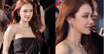 Nhã Phương mới thẩm mỹ lại 1 điểm