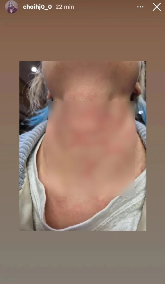 Nữ ca sĩ bị hành hung nghiêm trọng, còn bị ép viết thư xin lỗi Nữ ca sĩ bị hành hung nghiêm trọng, còn bị ép viết thư xin lỗi