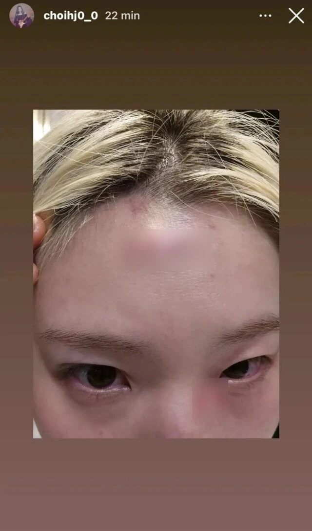 Nữ ca sĩ bị hành hung nghiêm trọng, còn bị ép viết thư xin lỗi Nữ ca sĩ bị hành hung nghiêm trọng, còn bị ép viết thư xin lỗi
