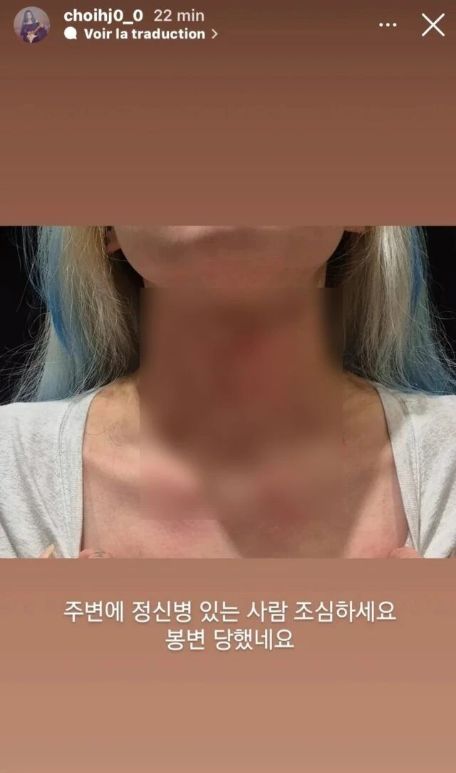 Nữ ca sĩ bị hành hung nghiêm trọng, còn bị ép viết thư xin lỗi Nữ ca sĩ bị hành hung nghiêm trọng, còn bị ép viết thư xin lỗi