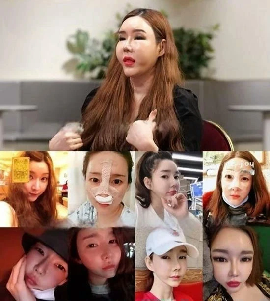 Sao chuyển giới chi 2,5 tỷ "dao kéo" toàn bộ gương mặt, 2 lần chia tay bạn trai trong nước mắt vì không thể sinh con Sao chuyển giới chi 2,5 tỷ "dao kéo" toàn bộ gương mặt, 2 lần chia tay bạn trai trong nước mắt vì không thể sinh con
