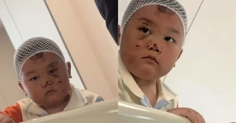 Bé trai 3 tuổi túc trực chăm mẹ sau tai nạn nghiêm trọng: Mặc dù chính bé bị nhiều vết thương đau đớn nhưng vẫn theo sát mẹ không rời