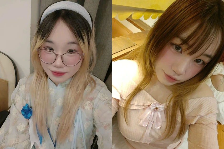 Bị ung thư xương phải cắt cụt chi năm 15 tuổi, nữ sinh vì mẹ mà "tái sinh" Bị ung thư xương phải cắt cụt chi năm 15 tuổi, nữ sinh vì mẹ mà "tái sinh"