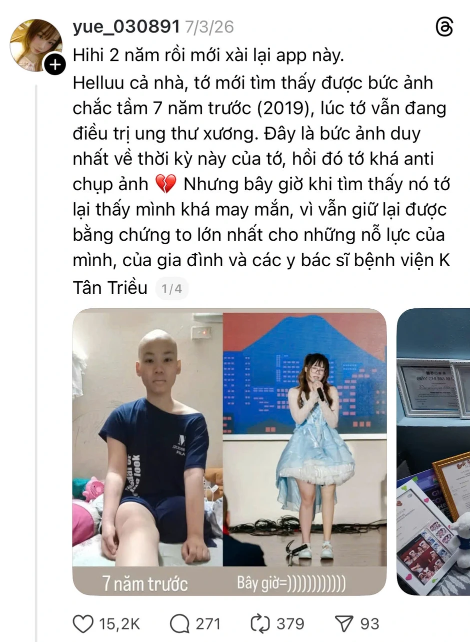 Bị ung thư xương phải cắt cụt chi năm 15 tuổi, nữ sinh vì mẹ mà "tái sinh" Bị ung thư xương phải cắt cụt chi năm 15 tuổi, nữ sinh vì mẹ mà "tái sinh"